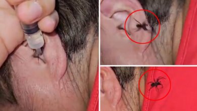 ایک شخص کے کان سے زندہ مکڑی رینگتے ہوئے نکل آئی، ویڈیو وائرل