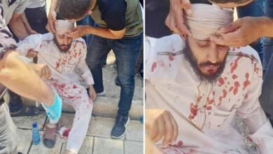 اسرائیلی پولیس کا نماز جمعہ کے دوران مسجد اقصی پر حملہ