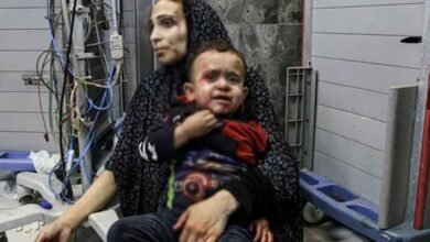 غزہ کے اسپتالوں میں سہولیات ختم،بے ہوش کیے بغیر آپریشن کیے جا رہے ہیں