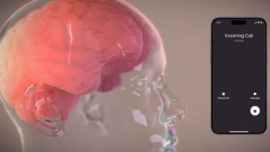 ایلون مسک کی کمپنی نیورالنک نے انسان میں پہلی دماغی چپ لگا دی