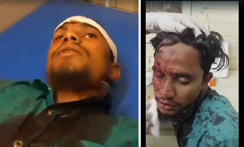 مسلم نوجوان پر حملہ کرنے والے ہنومان بھکت گرفتار، شرپسند عدالتی تحویل میں