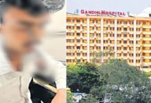Gandhi Hospital، نوجوان کی آنکھ میں پھنسے اسکروڈرائیور کوگاندھی اسپتال کے ڈاکٹرس نے کامیابی سے نکالا