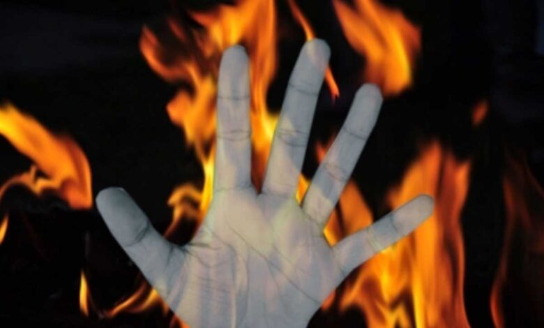 تلنگانہ کے نارائن پیٹ ضلع میں شارٹ سرکٹ کے باعث آگ ، 13 سالہ نابینا لڑکی زندہ جل گئی