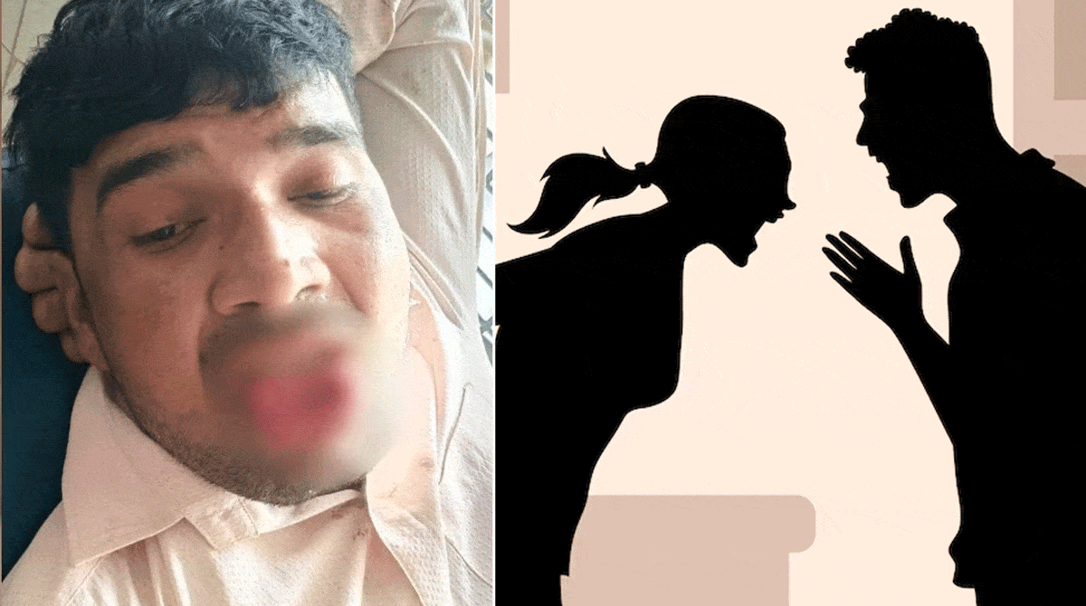 گرل فرینڈ نے زبردستی بوسہ لینے کی کوشش پر بوائے فرینڈ کی زبان کا حصہ کتردیا