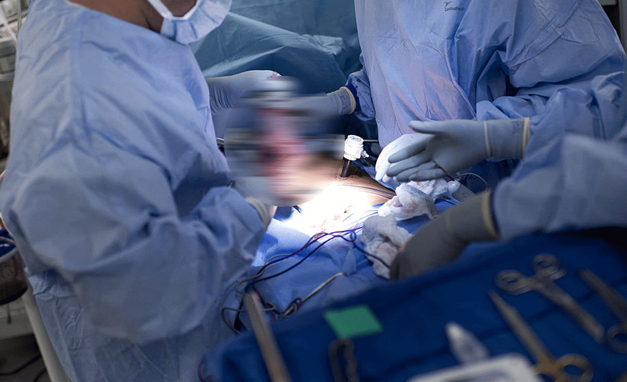 انسان میں بدجانور کی کڈنی کا کامیاب ٹرانسپلانٹ