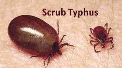 اے پی: اسکرب ٹائفس سے مرنے والوں کی تعداد 20 ہوگئی