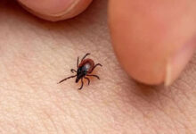 اے پی: اسکرب ٹائفس کے ایک ماہ میں 19مثبت معاملات، تشویش کا سبب