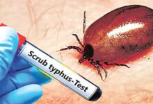 اے پی: اسکرب ٹائیفس کے بڑھتے معاملات پر محکمہ صحت نے عوام کے لئے سخت انتباہ جاری