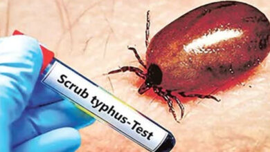 اے پی: اسکرب ٹائیفس کے بڑھتے معاملات پر محکمہ صحت نے عوام کے لئے سخت انتباہ جاری