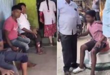 تلنگانہ کے آمنگل میں پاگل کتے کی دہشت، 36 افراد کو کاٹ کر زخمی کردیا