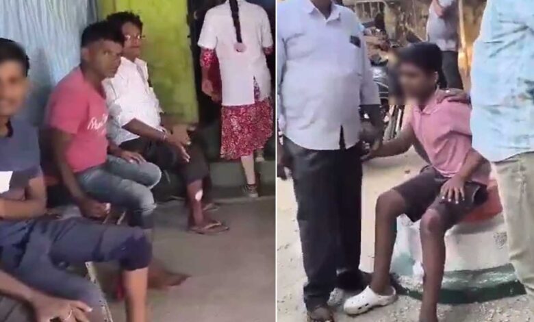 تلنگانہ کے آمنگل میں پاگل کتے کی دہشت، 36 افراد کو کاٹ کر زخمی کردیا