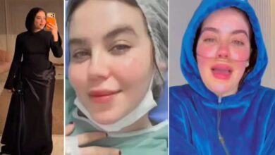 خاتون انفلوئنسر نے کینسر کا ڈرامہ رچا کر اپنے فالوورز سے لاکھوں روپے بٹور لئے۔ پرتعیش طرزِ زندگی نے کھول دی پول