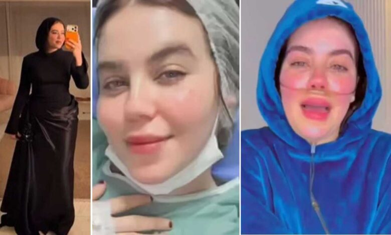 خاتون انفلوئنسر نے کینسر کا ڈرامہ رچا کر اپنے فالوورز سے لاکھوں روپے بٹور لئے۔ پرتعیش طرزِ زندگی نے کھول دی پول
