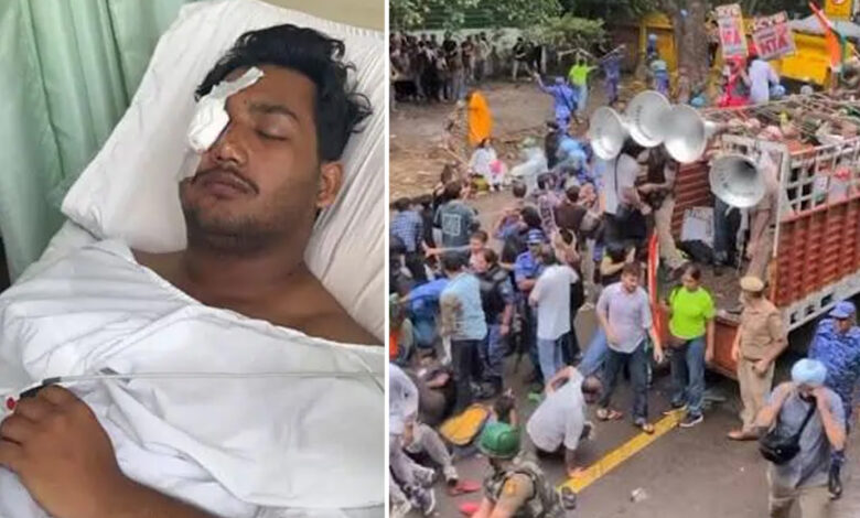 دہلی احتجاج میں زخمی طالب علم کی بینائی خطرے میں، ساحل پولیس میں ملازمت کے خواب دیکھ رہا تھا