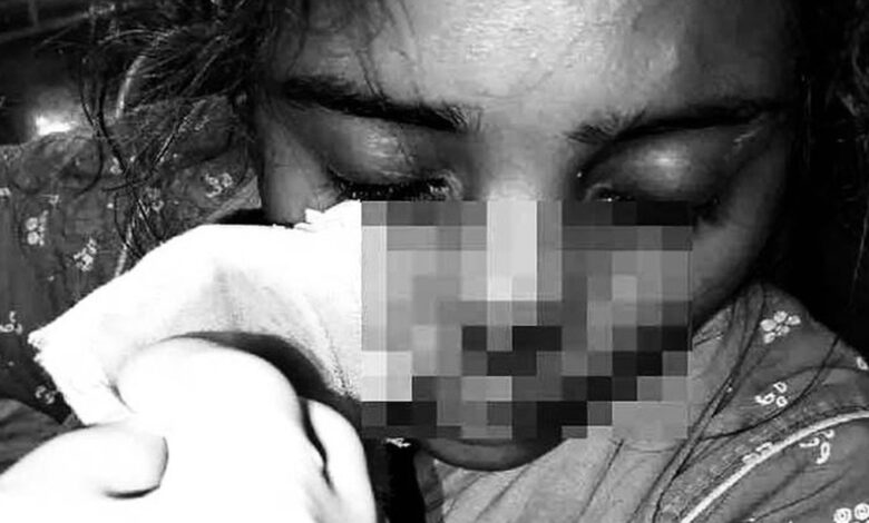 ماں کے گھر سے واپس آنے سے انکار، شوہر نے بیوی کی ناک ہی کاٹ دی