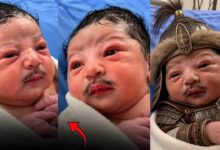 گھنی مونچھوں والے نومولود کی ویڈیو وائرل، کیا واقعی ایسا بچہ پیدا ہوسکتا ہے؟