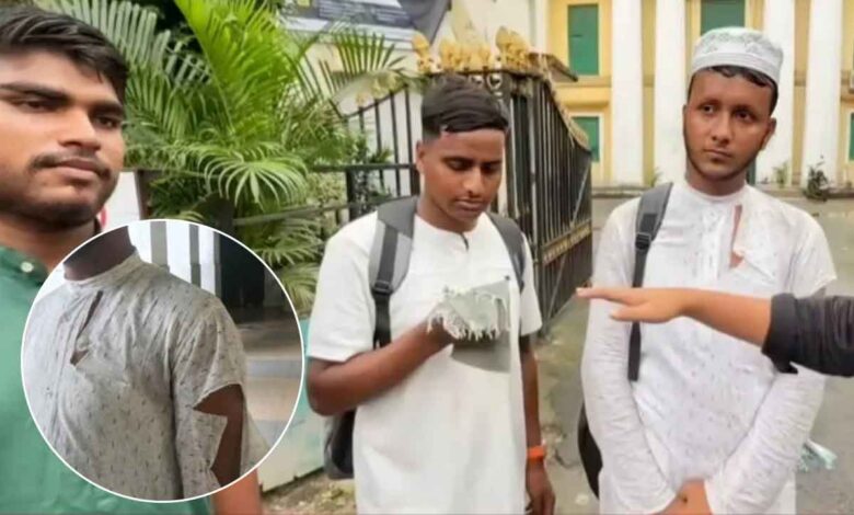 یونیورسٹی کے 3 مسلم طلبہ پر مبینہ حملہ، داڑھی اور ٹوپی دیکھ کر ’جہادی‘ کہہ کر تشدد کا الزام