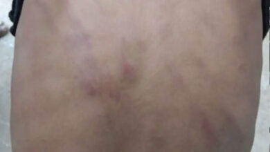 تلنگانہ میں دوسری جماعت کے طالب علم پر استاد کا مبینہ تشدد